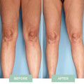 Nooro Knee Massager - Knee Pain Relief Device (gec)