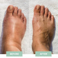 EMS-Regenerating Foot Massager