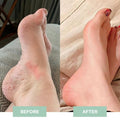 EMS-Regenerating Foot Massager (bpr)